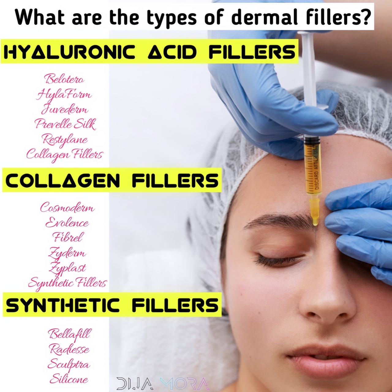 Dermal fillers Definition and types