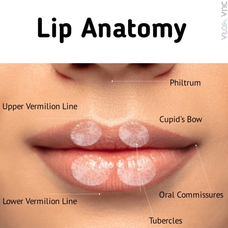 Lip filler injections