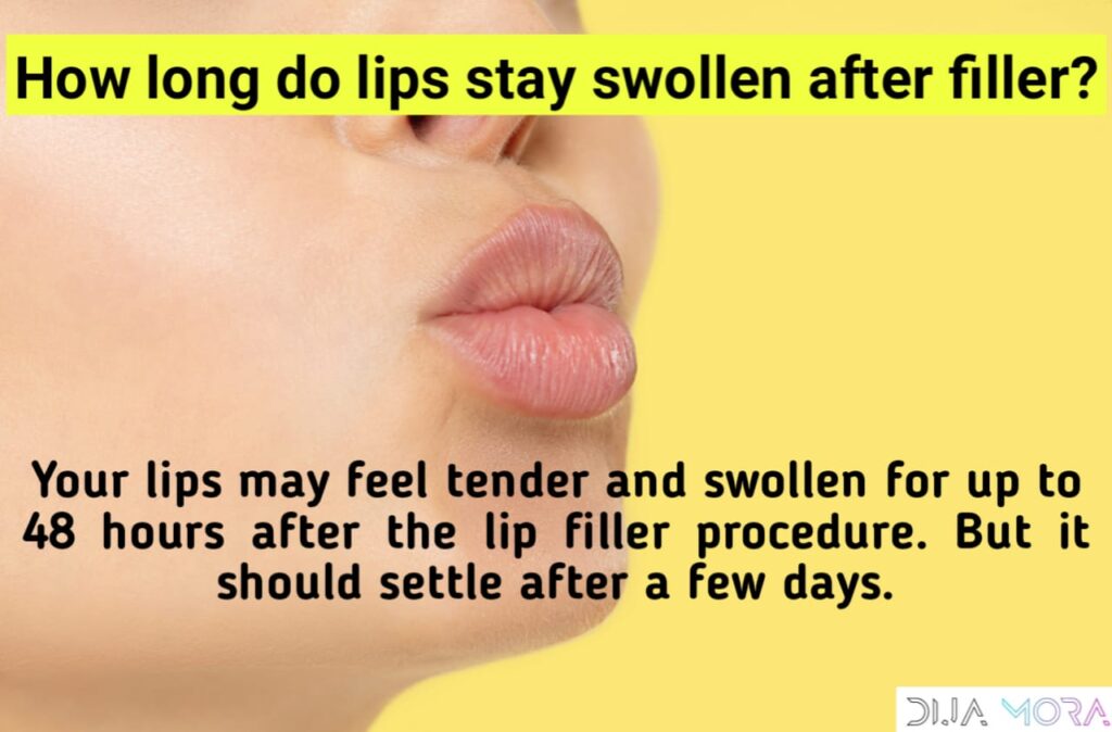 Lip filler healing process Tips for Fast healing