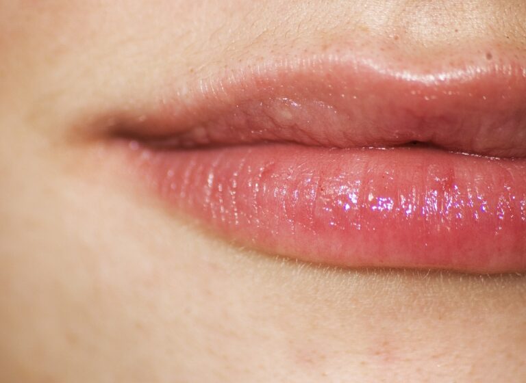 Most natural lip fillers