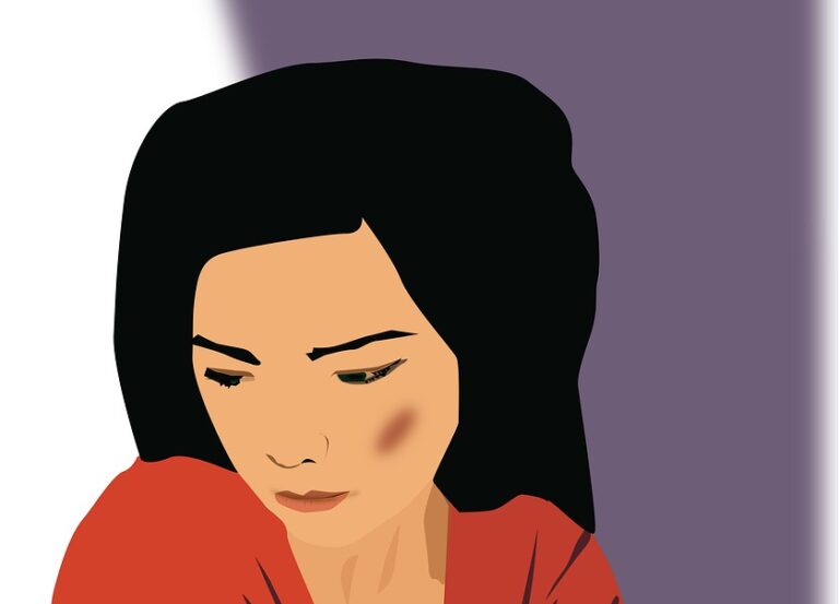 Cheek Filler Bruising: Beat Bruising with These Tips!