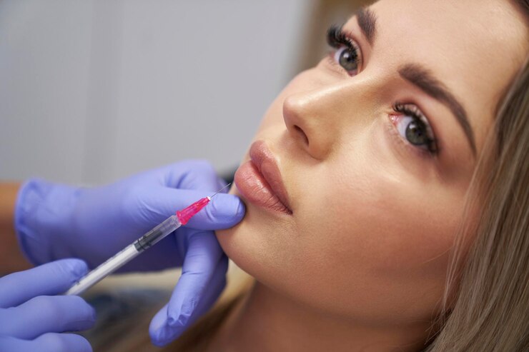 How long does it take for dermal fillers to settle?