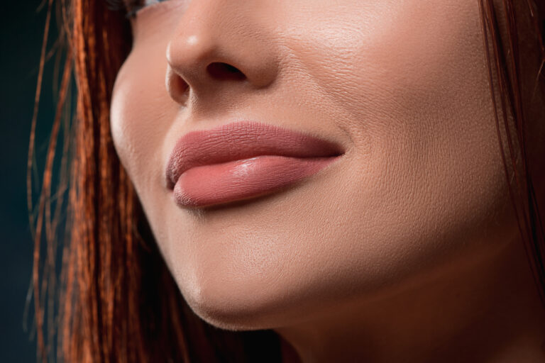 Lip fillers